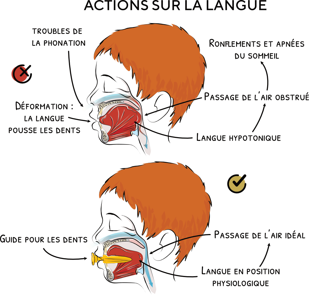 Description de l'image